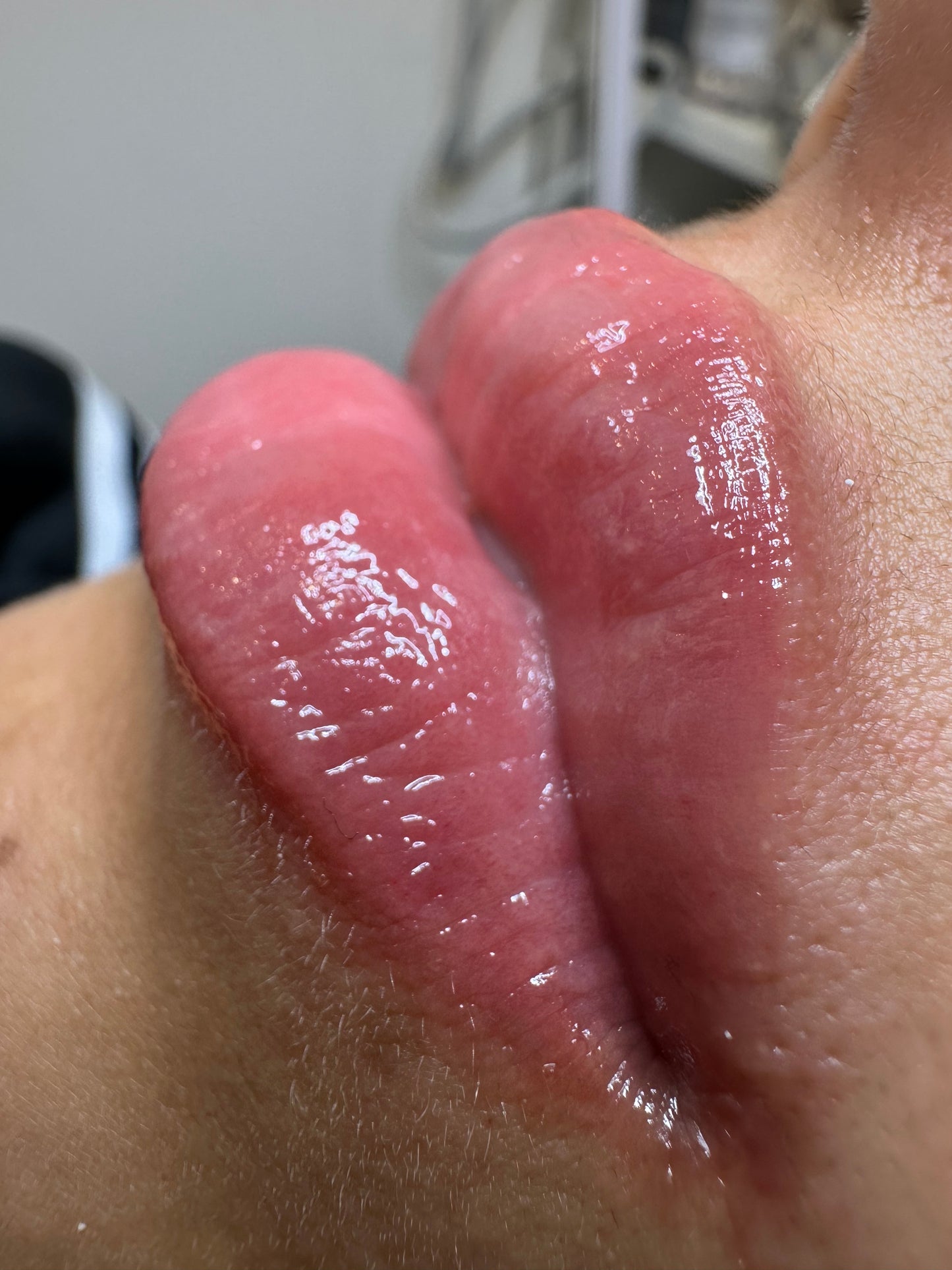 Formación Lips Glow